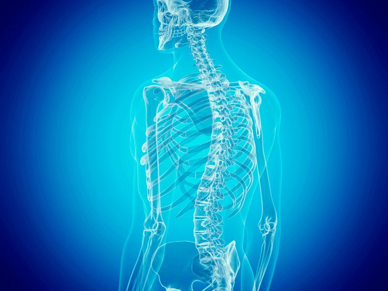Lưu ý quan trọng để ngăn ngừa tái phát cong vẹo cột sống