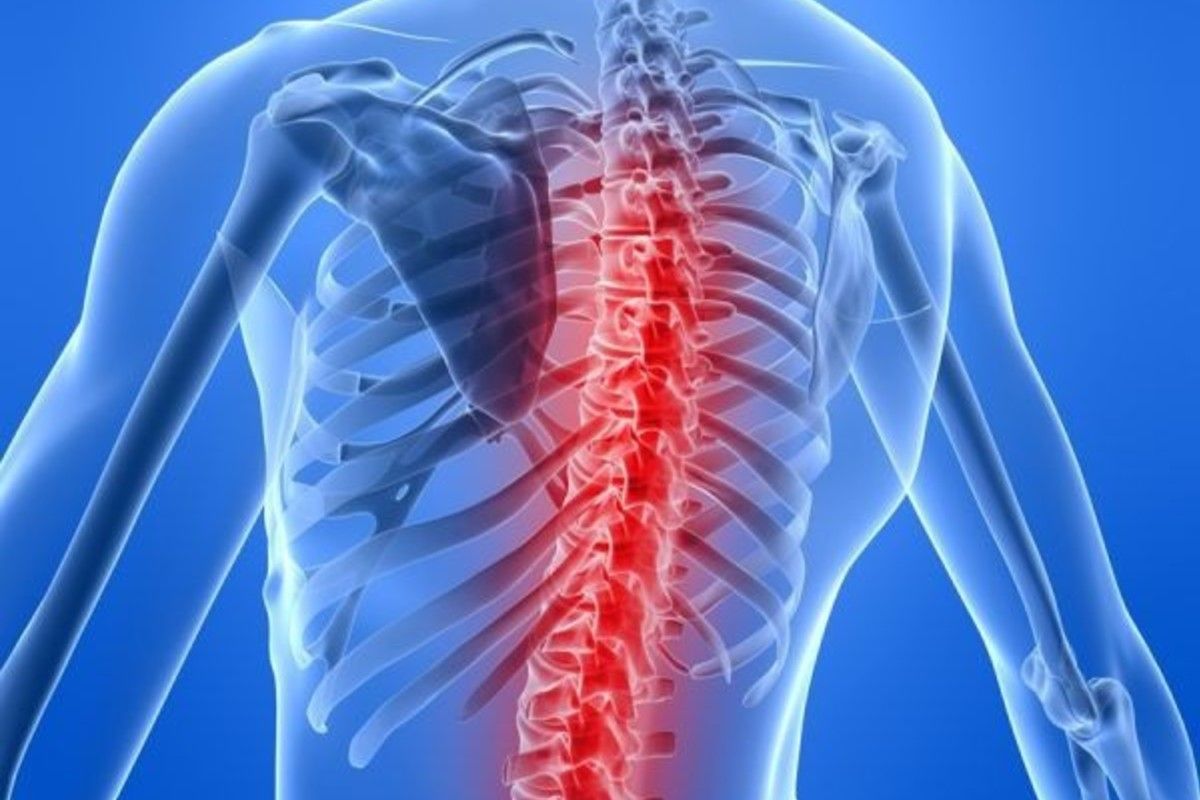 Những hệ quả khôn lường cho sức khỏe của bạn khi bị cong vẹo cột sống