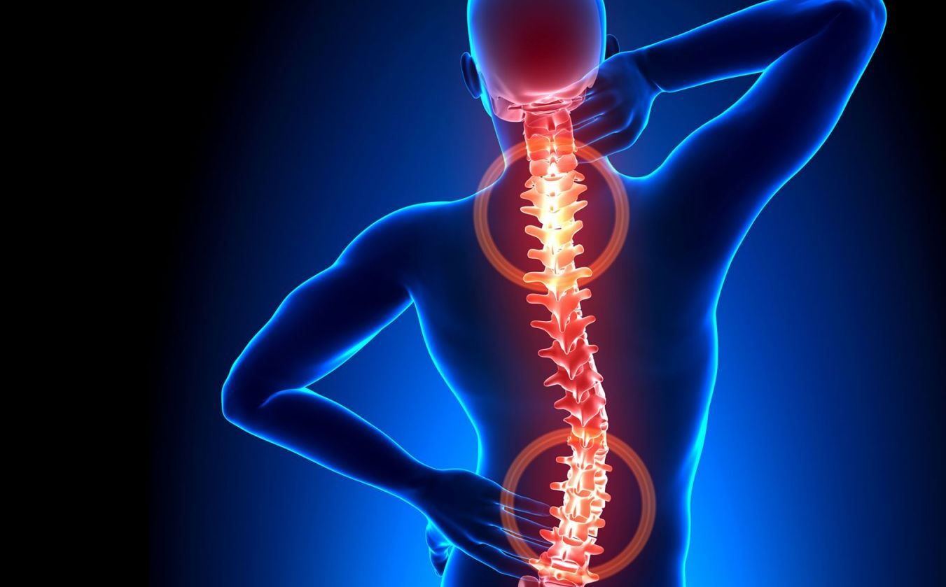 Thoát vị đĩa đệm có nguy hiểm không?