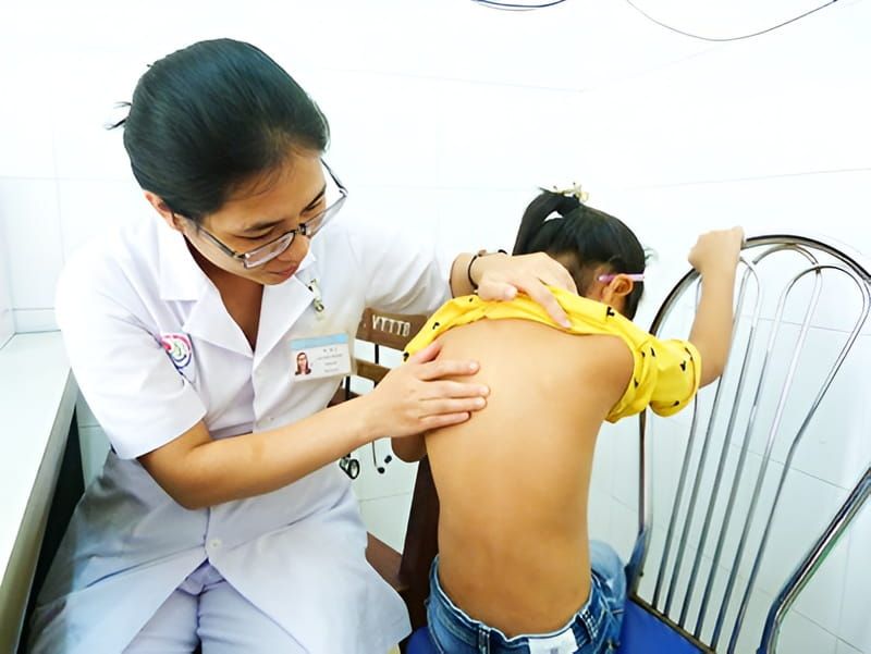 Cách chữa vẹo cột sống ở trẻ em