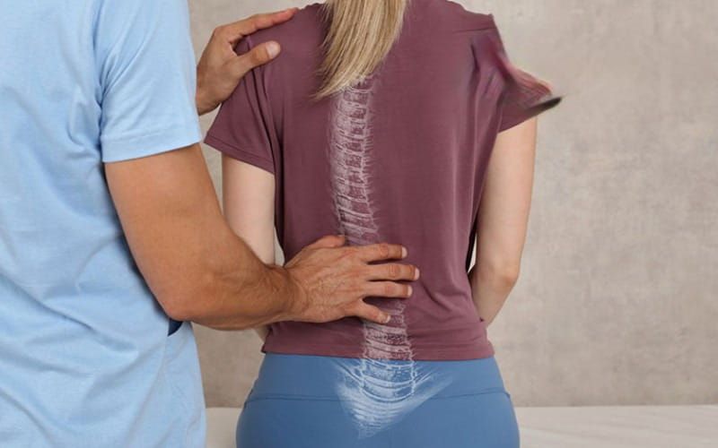 Cách chữa vẹo cột sống ở người lớn