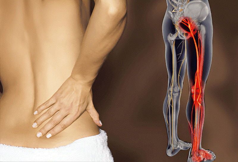 chạy bộ có giảm đau lưng