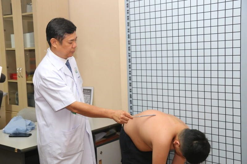 Cong vẹo cột sống có tái phát không