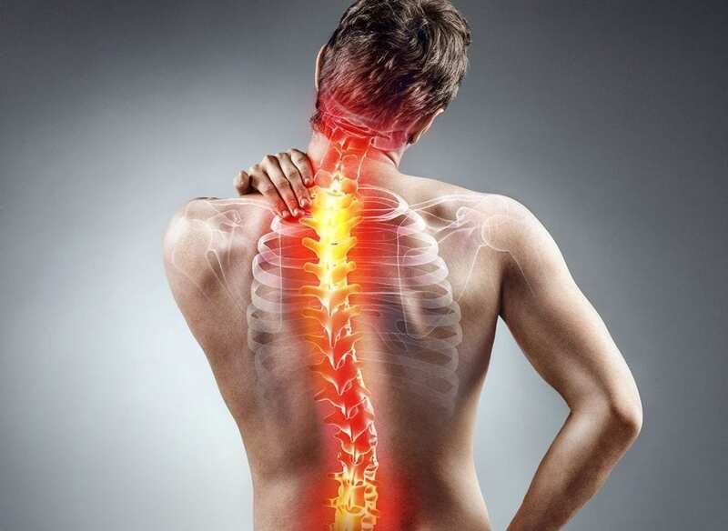 Cong vẹo cột sống có tái phát không