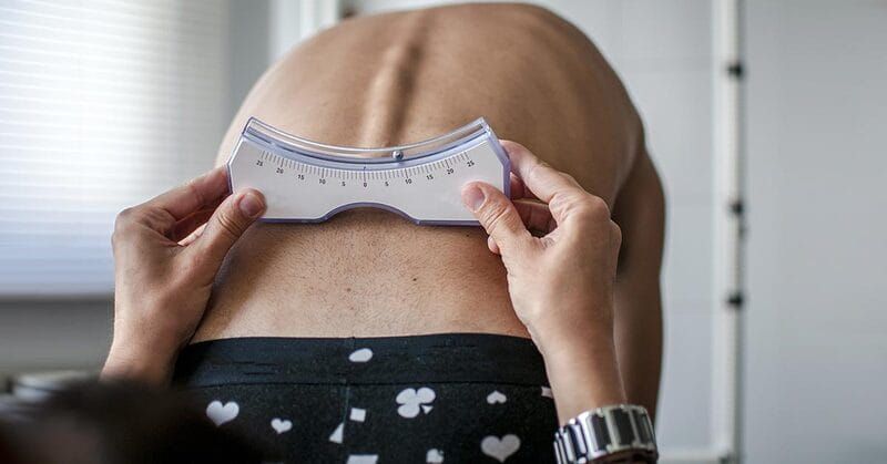 Các Phương Pháp Điều Trị Cong Vẹo Cột Sống Ở Người Lớn