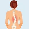 Vẹo Cột Sống Chữ C: Dấu Hiệu Nhận Biết Và Cách Điều Trị Hiệu Quả