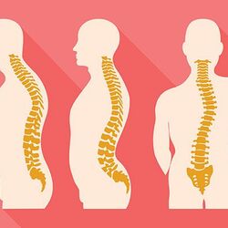 Cong vẹo cột sống có nguy hiểm không?