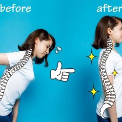 Điều trị bệnh cong vẹo cột sống Hồ Chí Minh uy tín