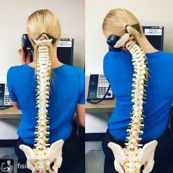 Nhận biết sớm dấu hiệu của cong vẹo cột sống