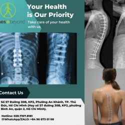 Địa chỉ chữa vẹo cột sống không cần phẫu thuật ở TPHCM chất lượng cao?