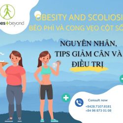 Béo phì và Cong vẹo cột sống