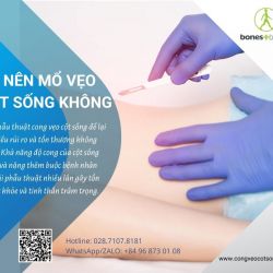 Vẹo cột sống có phải mổ không?