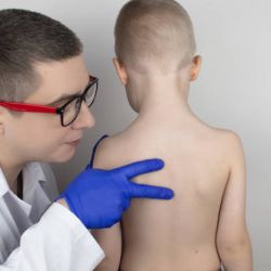 Cách điều trị hiệu quả vẹo cột sống trẻ em hiện nay