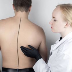 Các nguyên nhân phổ biến gây chứng cong vẹo cột sống
