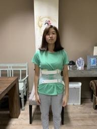 Bệnh nhân mặt áo nẹp 3D ở Bones and Beyond