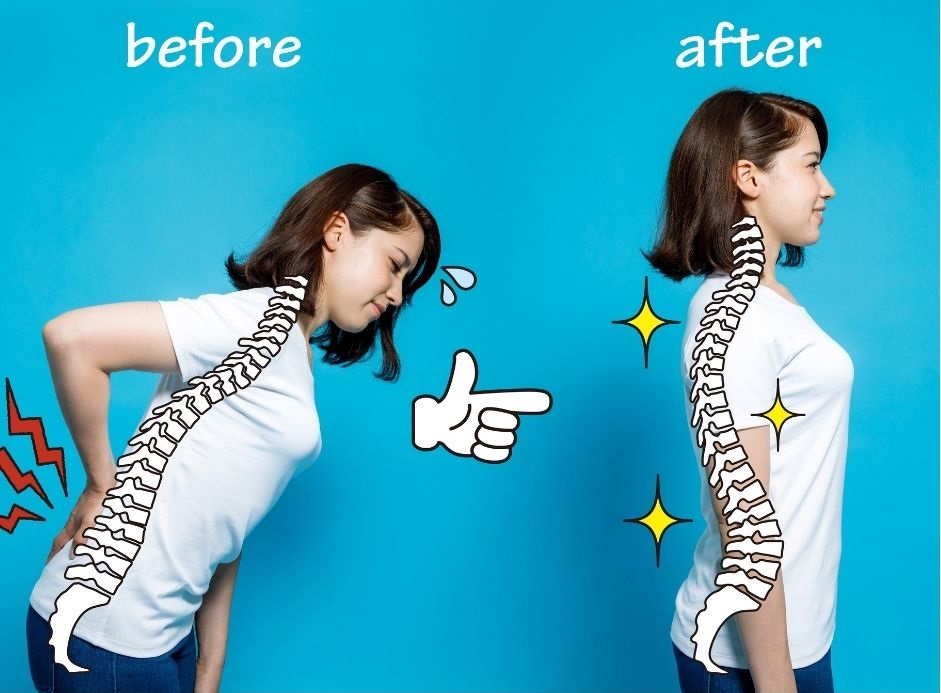 Điều trị bệnh cong vẹo cột sống Hồ Chí Minh uy tín