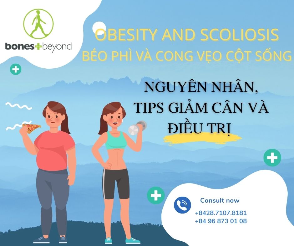 Béo phì và Cong vẹo cột sống