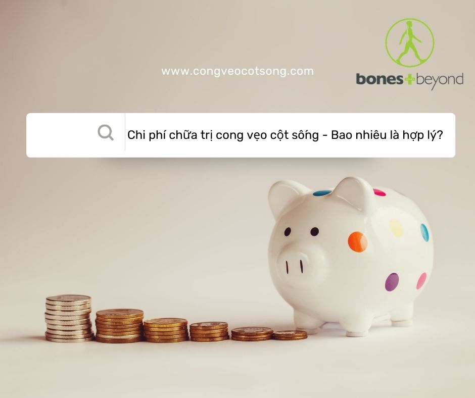 Chi phí chữa trị cong vẹo cột sống - Bao nhiêu là hợp lý?