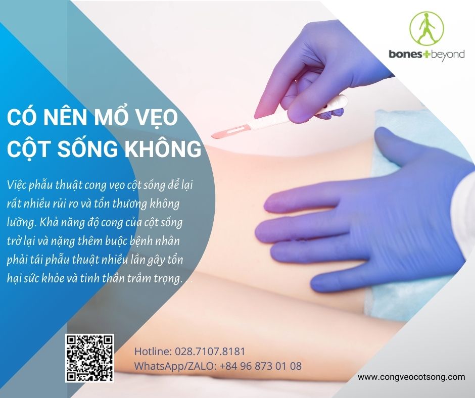 Vẹo cột sống có phải mổ không?