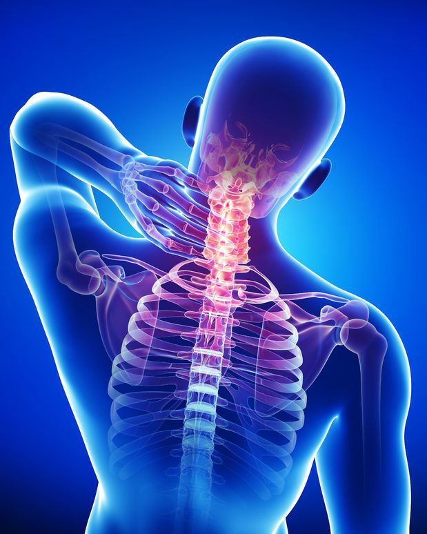 new-anterior-cervical-plate-makes-headlines