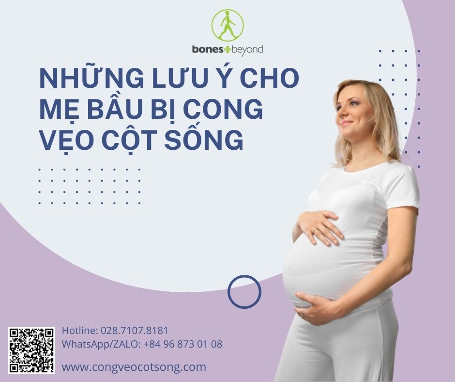 Cong vẹo cột sống ở phụ nữ mang thai