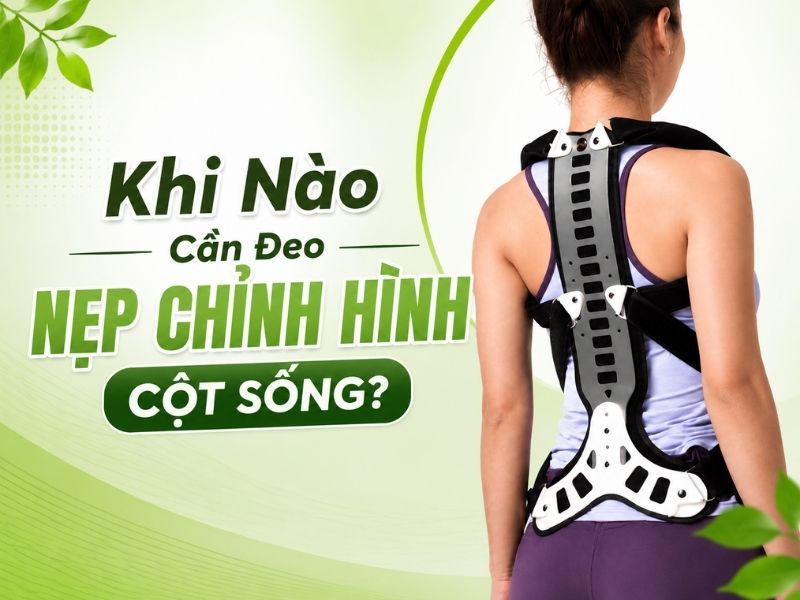 Khi Nào Cần Đeo Nẹp Chỉnh Hình Cột Sống?
