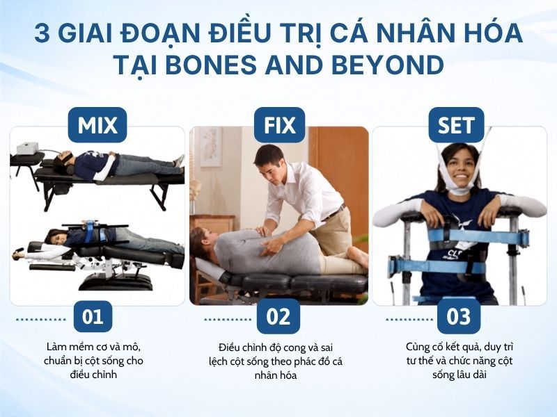 Đánh Giá Và Điều Trị Vẹo Cột Sống 20 Độ Theo Phương Pháp Clear Tại Bones And Beyond