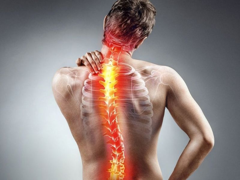 Vẹo Cột Sống 20 Độ Có Cần Đeo Nẹp Hay Phẫu Thuật Không?
