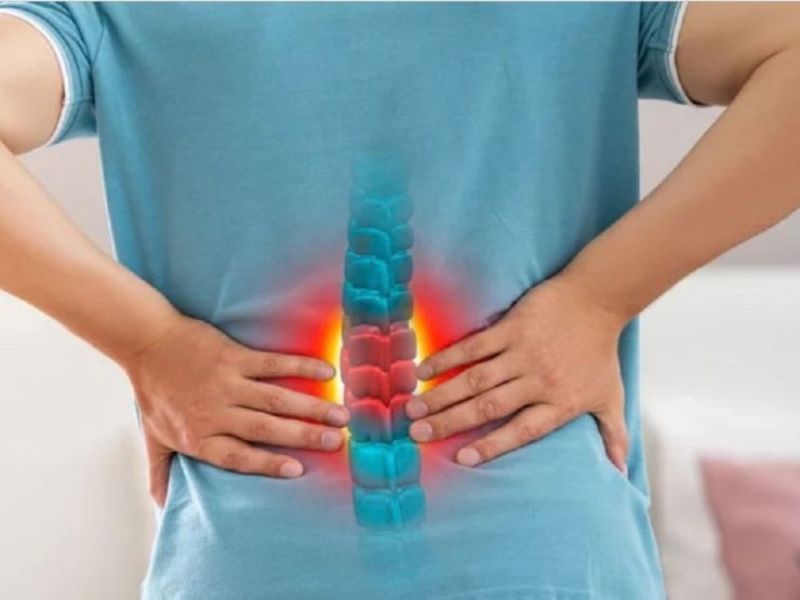 Vẹo Cột Sống 30 Độ Là Gì? Thuộc Mức Độ Nặng Hay Nhẹ?