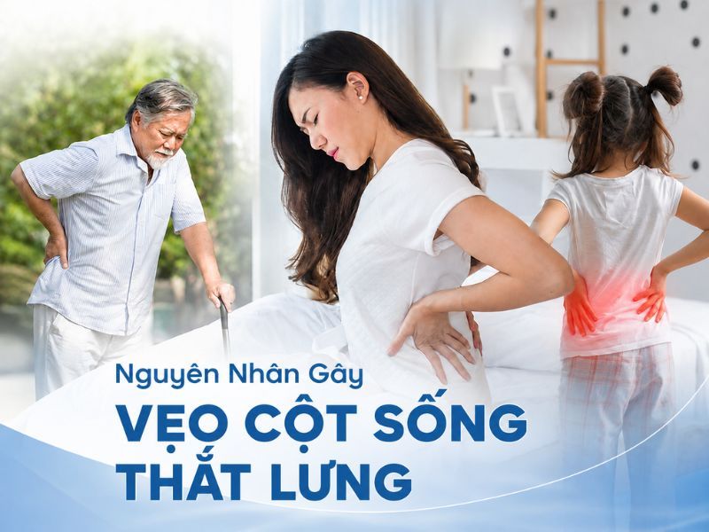 Nguyên Nhân Gây Vẹo Cột Sống Thắt Lưng