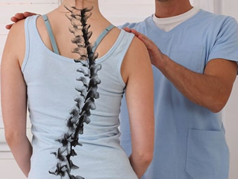 Vẹo Cột Sống Thắt Lưng: Nguyên Nhân Và Cách Điều Trị